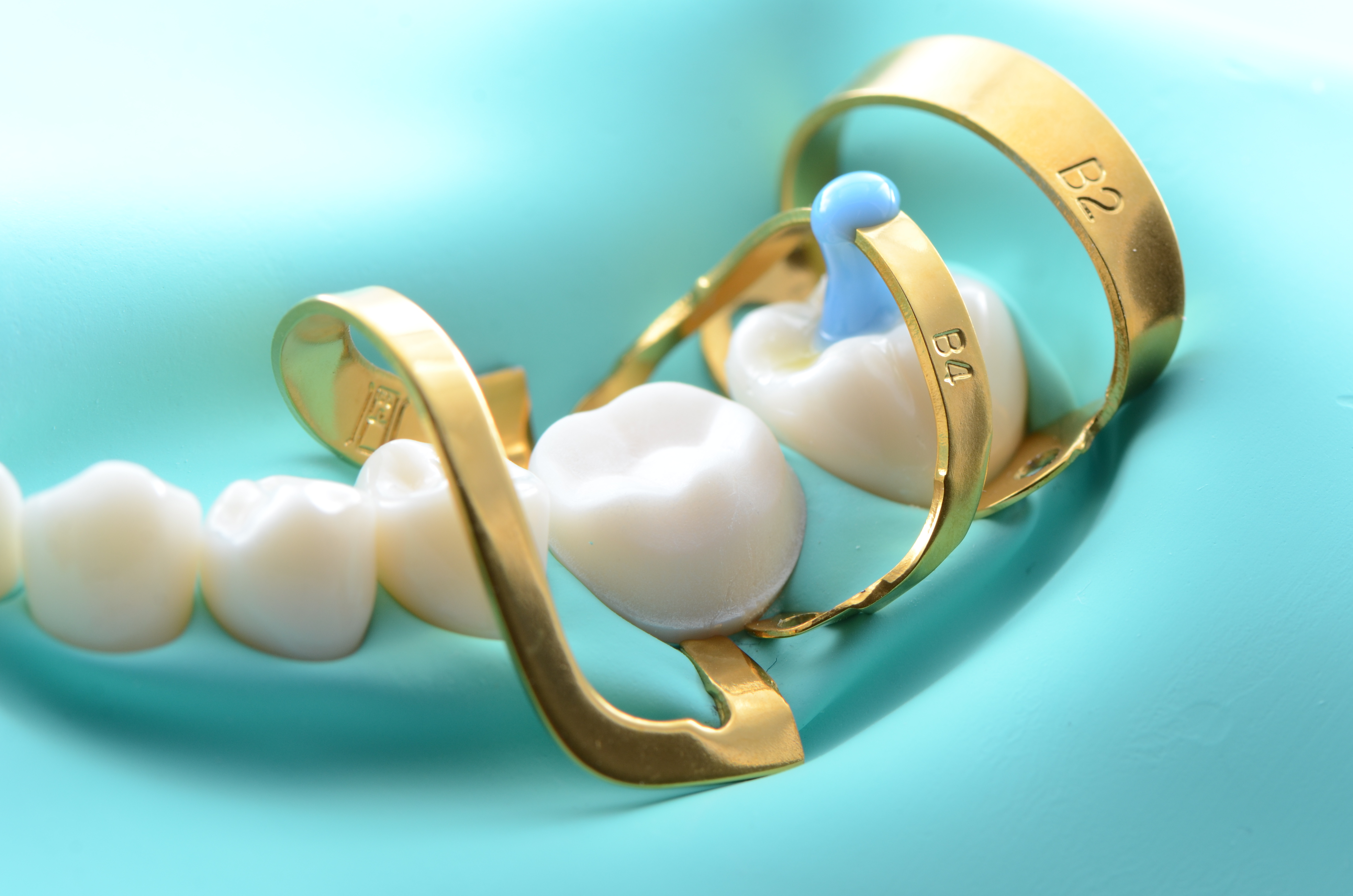 歯の移植のメリット